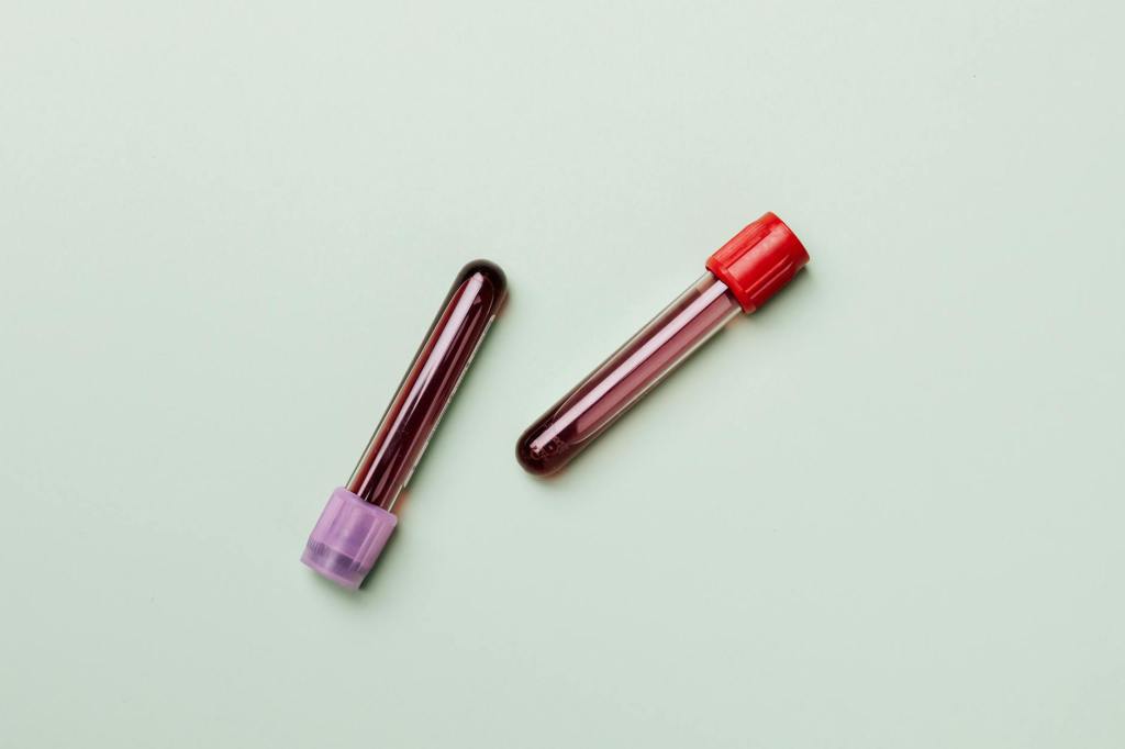 Food Allergy Blood Test&nbsp;Myths