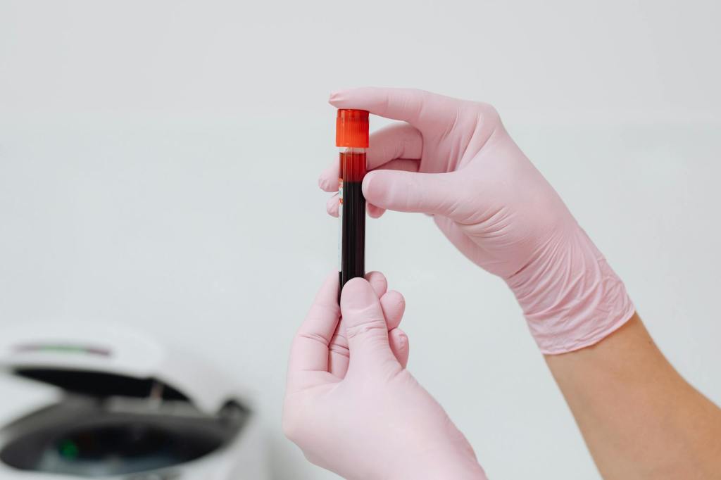 Beyond LDL: Why Apolipoprotein B May Be the Cholesterol Marker You’ve Never Heard&nbsp;Of