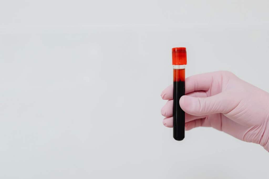 Medical Myths or Facts #54 – Is Higher HDL Always&nbsp;Better?