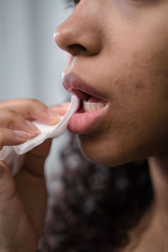 Canker Sores: What Actually Works (and When to&nbsp;Worry)
