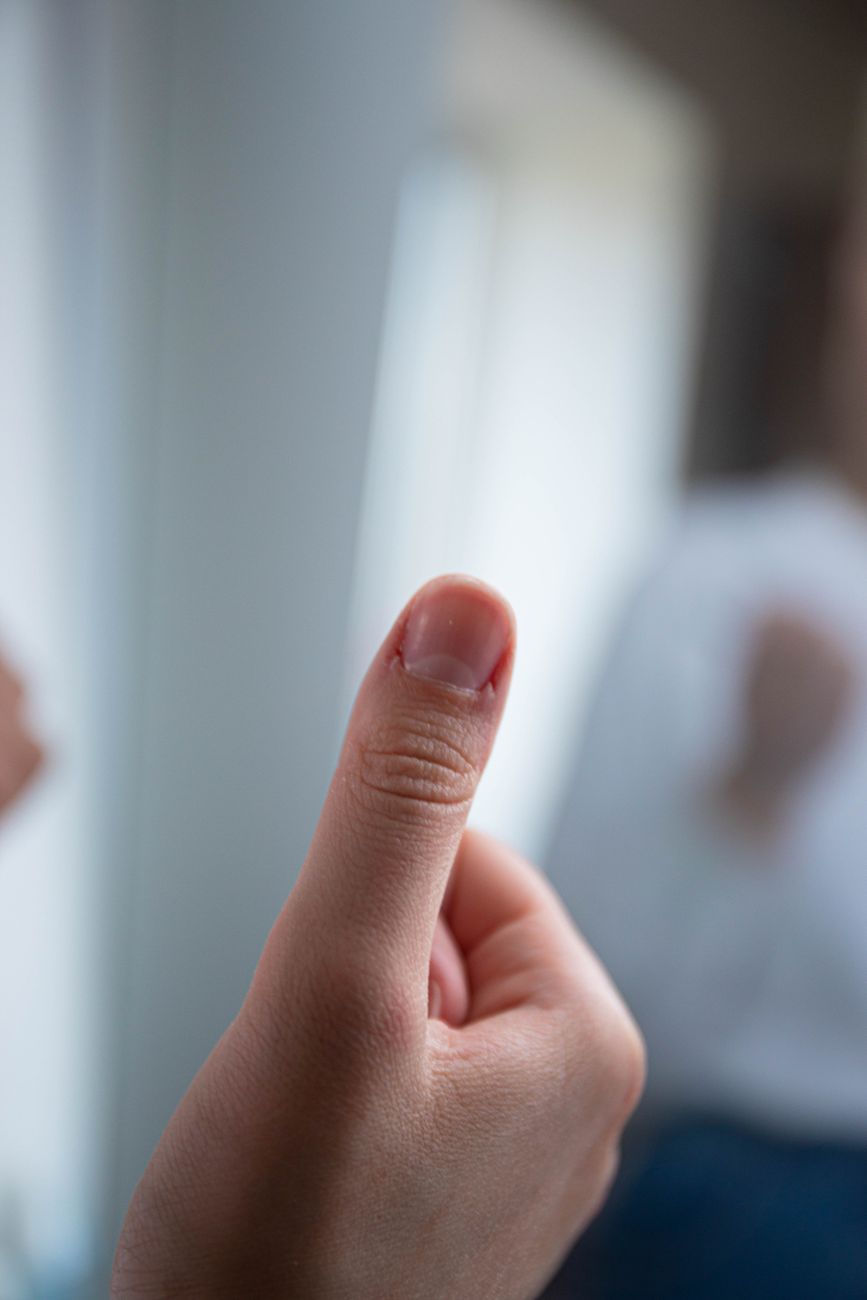 Warm or Cold? The Right Way to Treat a Nail Fold&nbsp;Infection